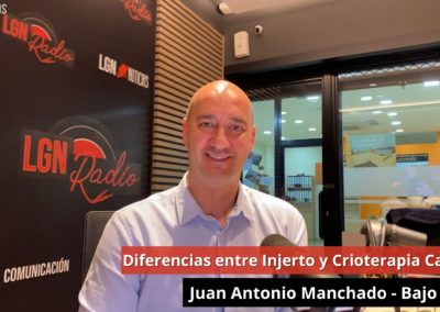 19/03/24 Juan Antonio Manchado – Diferencias entre injerto y Crioterapia capilar. Bajo Cero