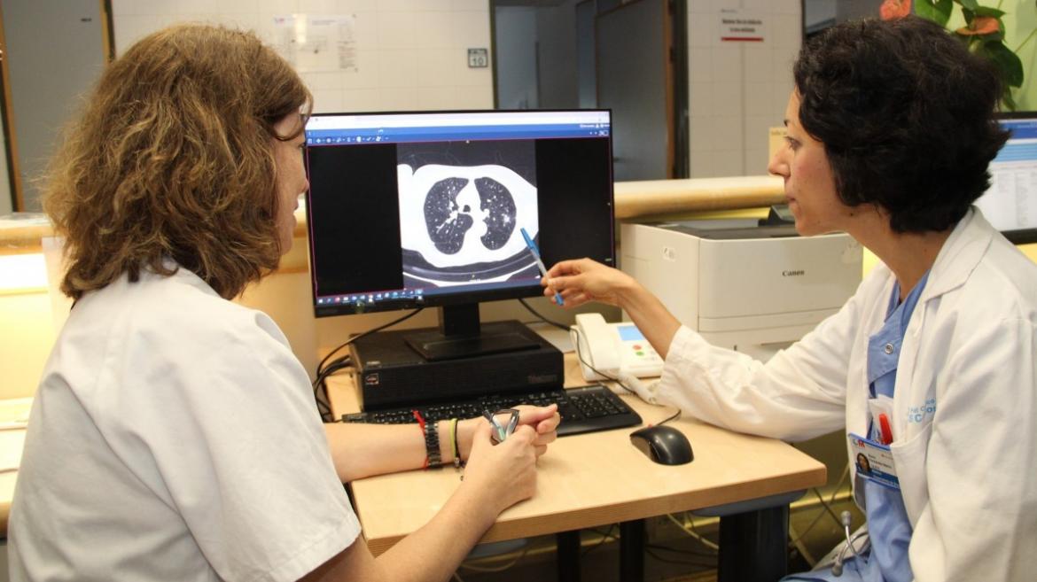 El Hospital Clínico San Carlos lanza un proyecto para el cribado del cáncer de pulmón