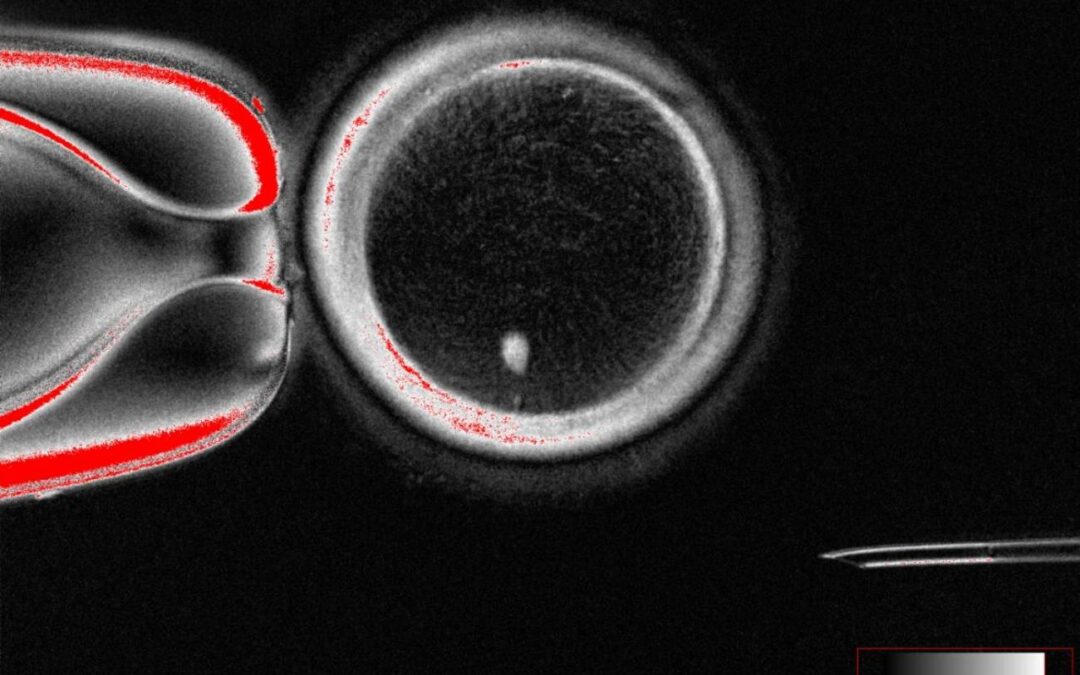 Científicos logran óvulos humanos funcionales a partir de células de la piel